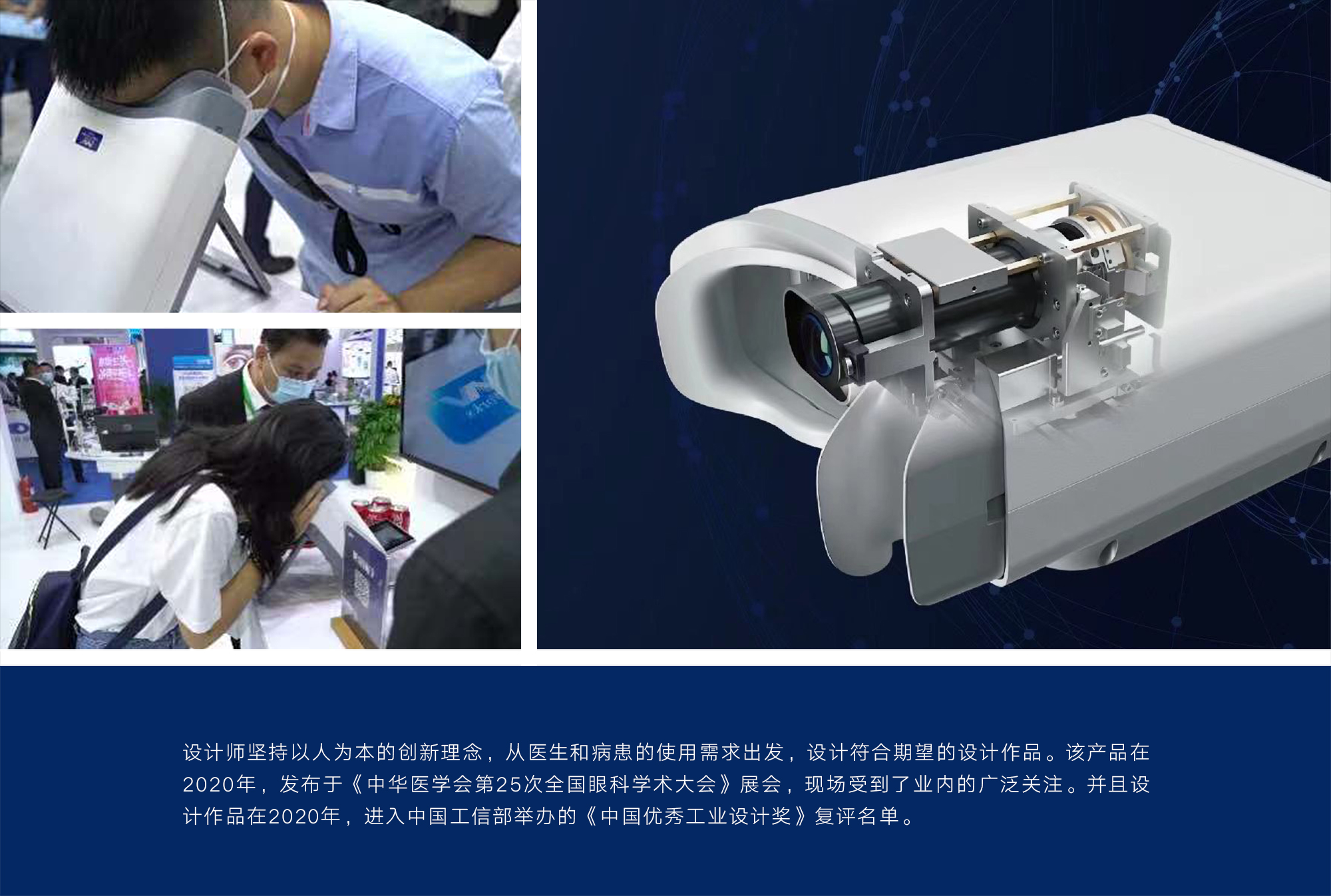 industrial design，Appearance design，medical apparatus and instruments，Handheld device，China excellent industrial design award，