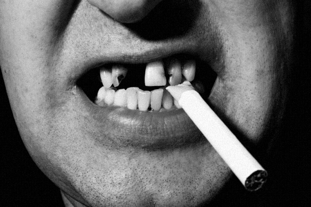 烟，烟盒，牙齿，健康，警示，