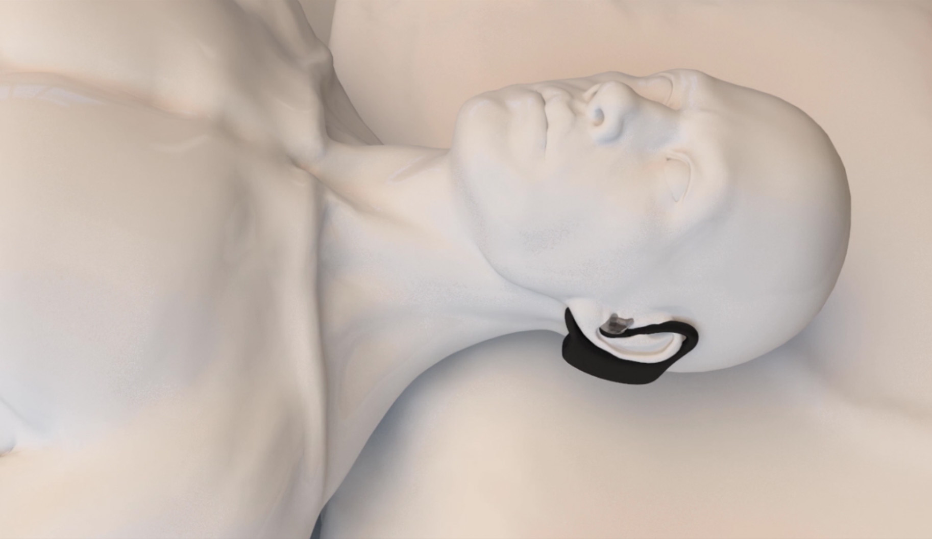 Anti Snoring artifact，