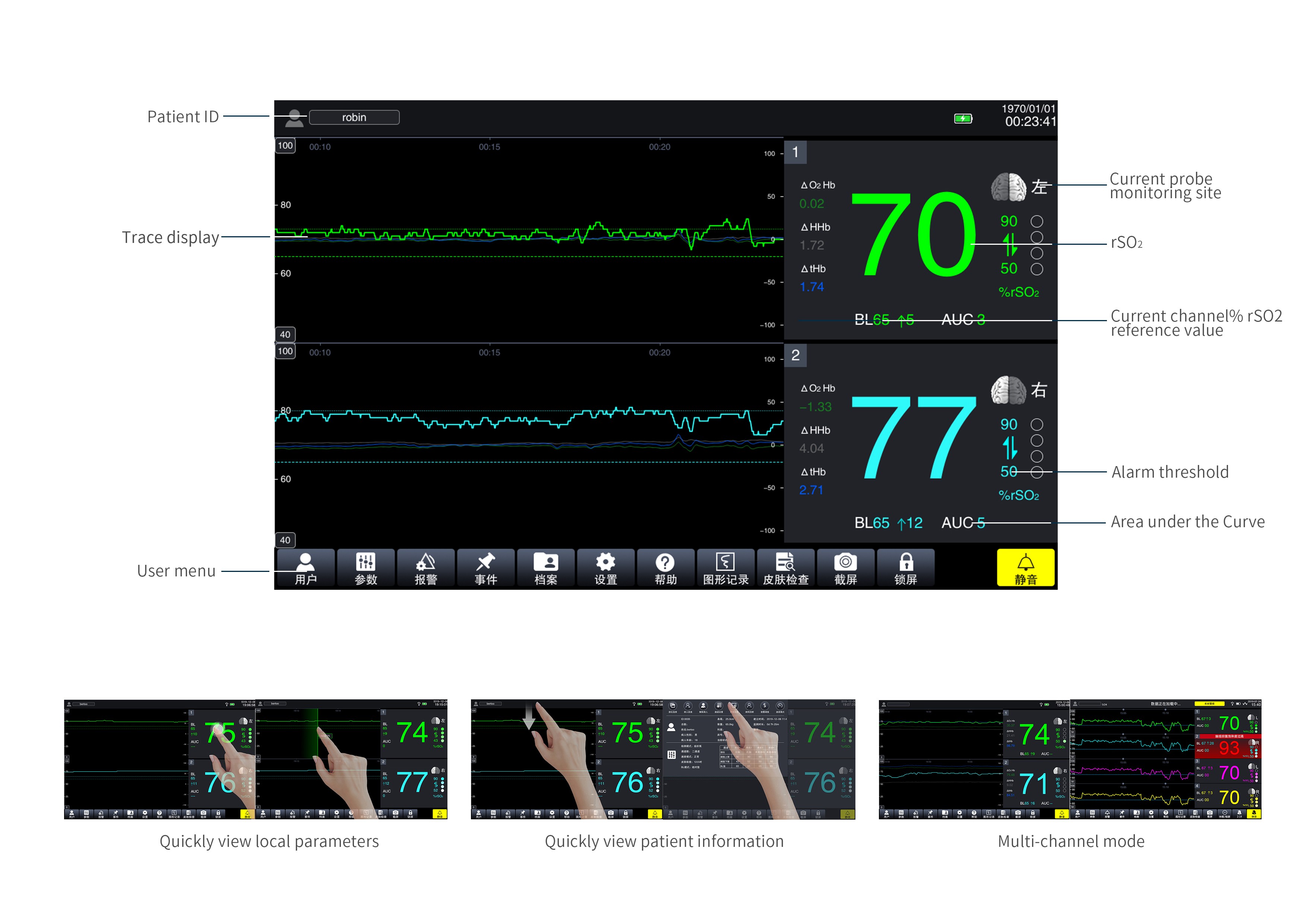 Intelligent device，Detector，2020 CGD contemporary good design award，Bolian Zhongke (Wuhan) Technology Co., Ltd，