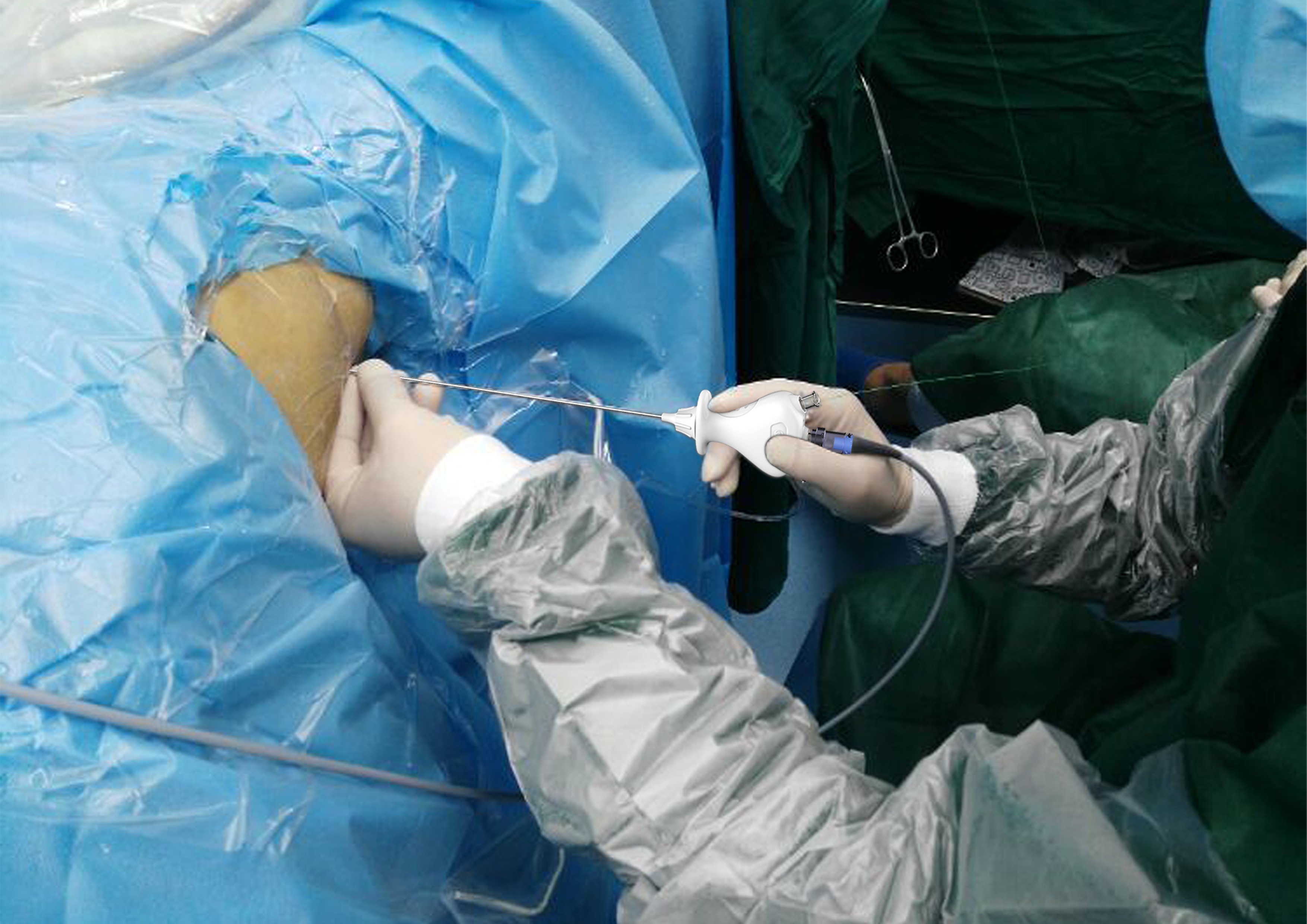 Renal dilator，2020 CGD contemporary good design award，Jiangsu Huaxia Xingguang Technology Co., Ltd，