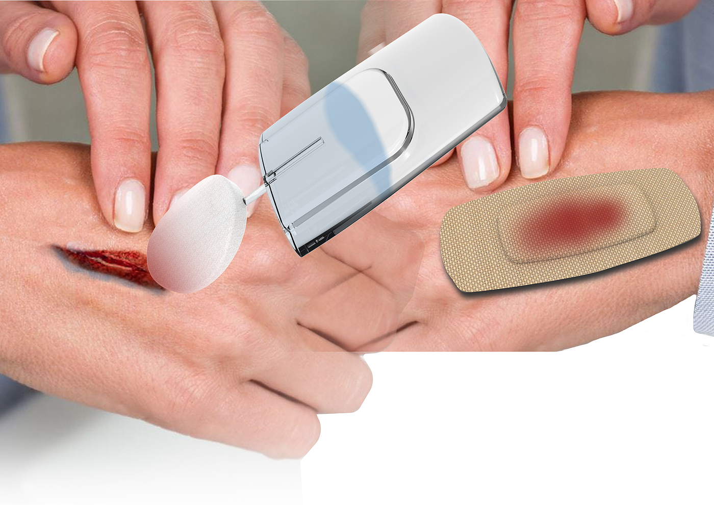 Wound cleaning kit，Winning award，China "Wenqi Award"，