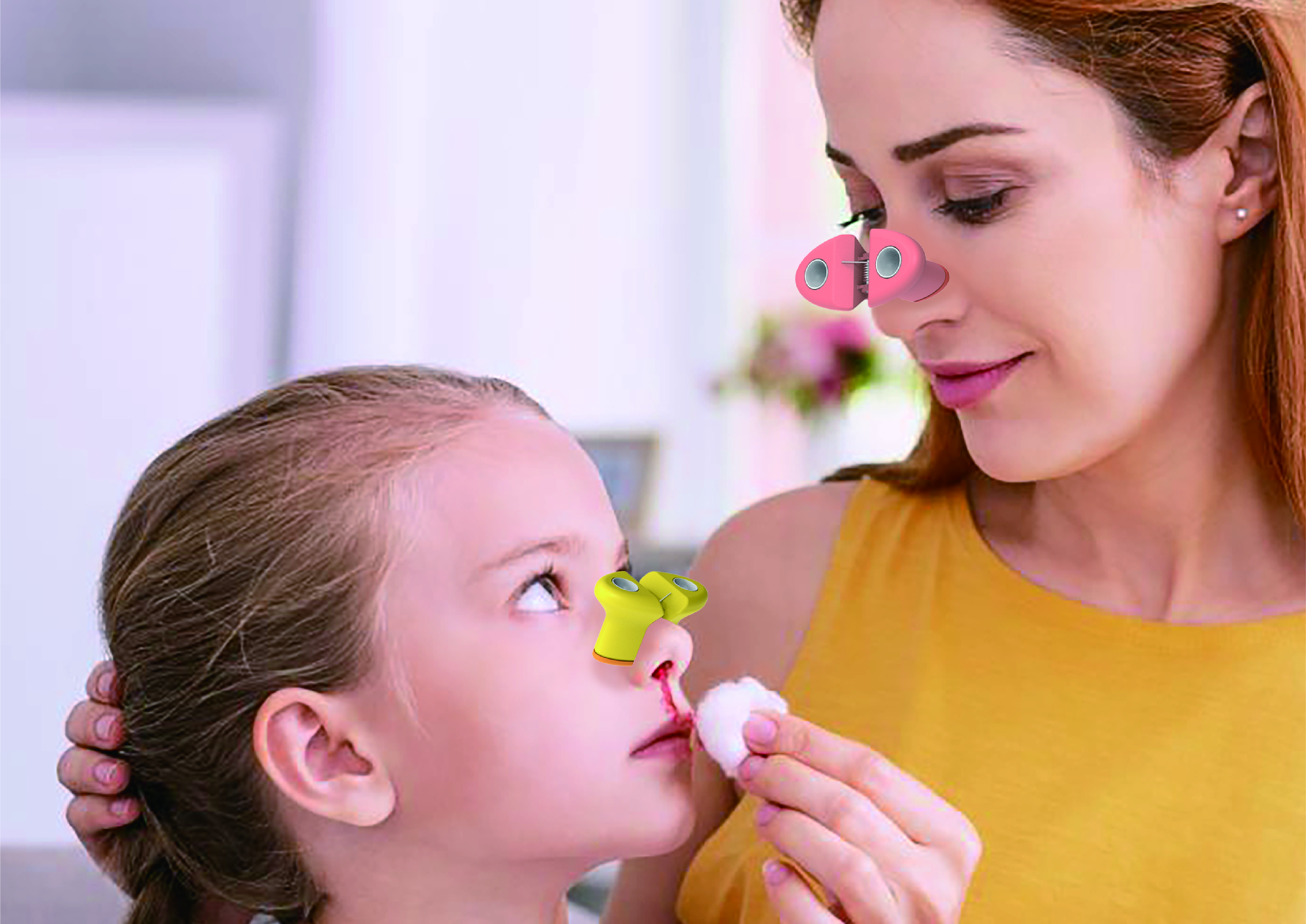 Nasal blood hemostatic clip，Winning award，China "Wenqi Award"，