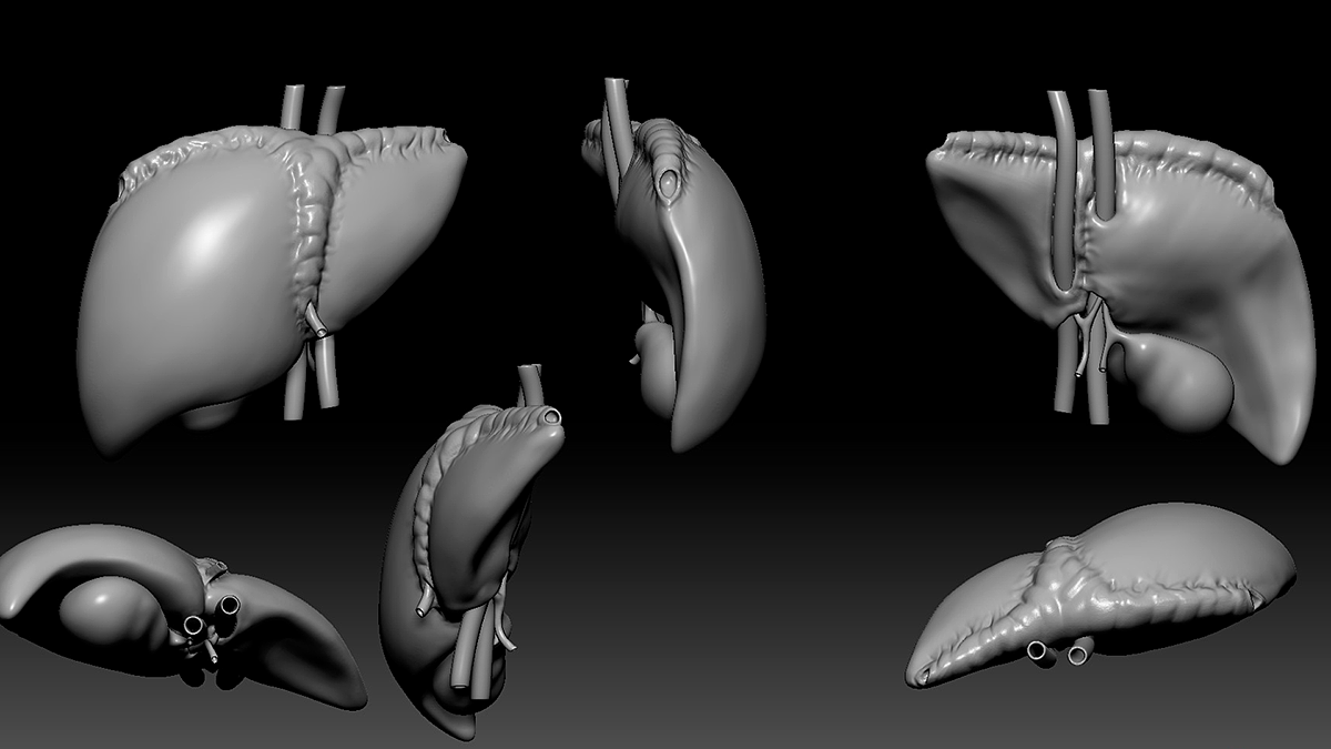Bioprinting，3D printing，Cells，