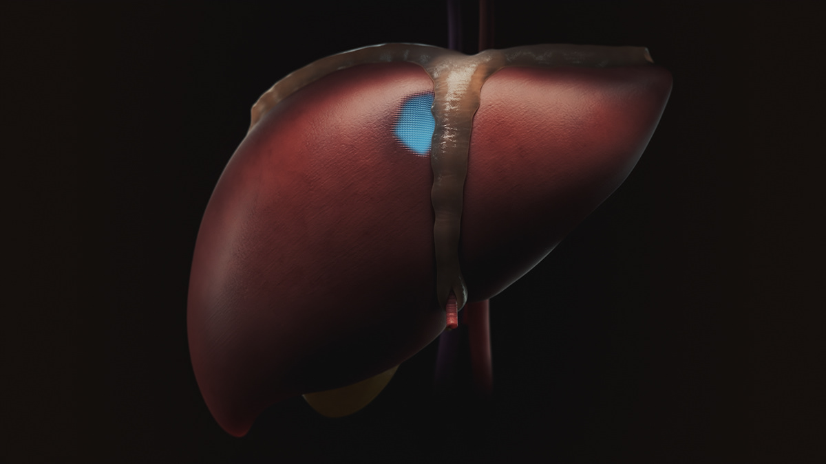 Bioprinting，3D printing，Cells，