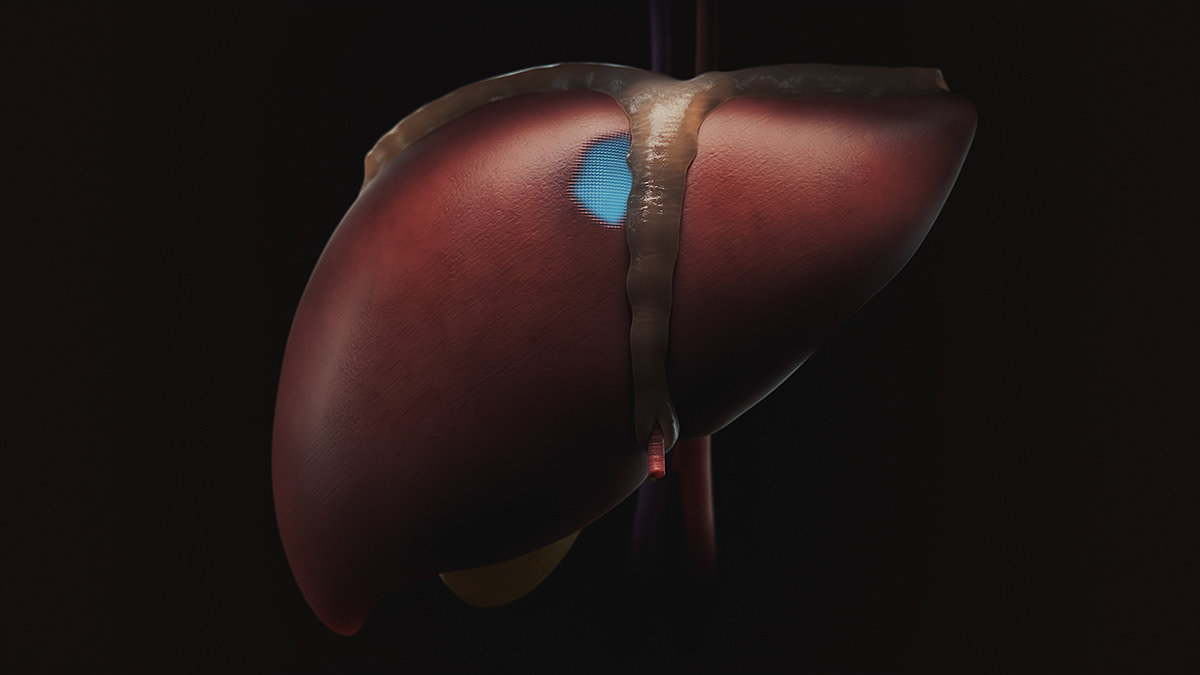 Bioprinting，3D printing，Cells，