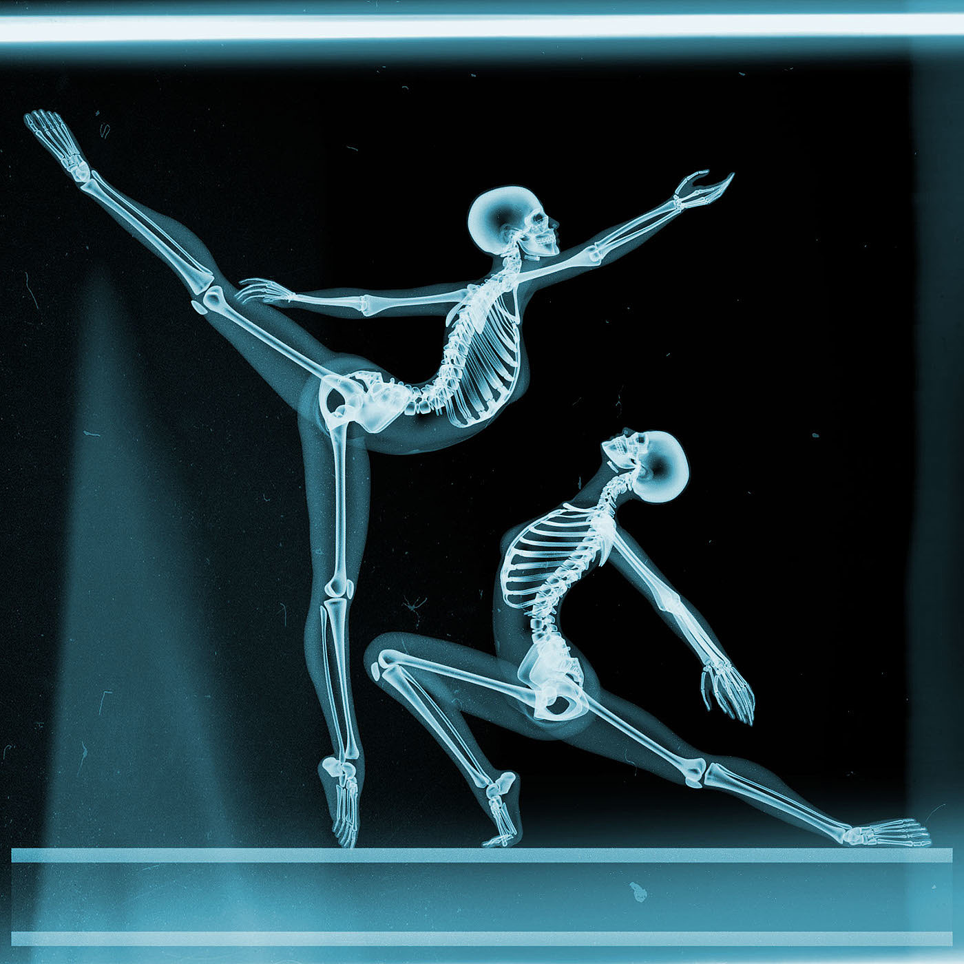 perspective，medical care，X-ray，originality，human skeleton，