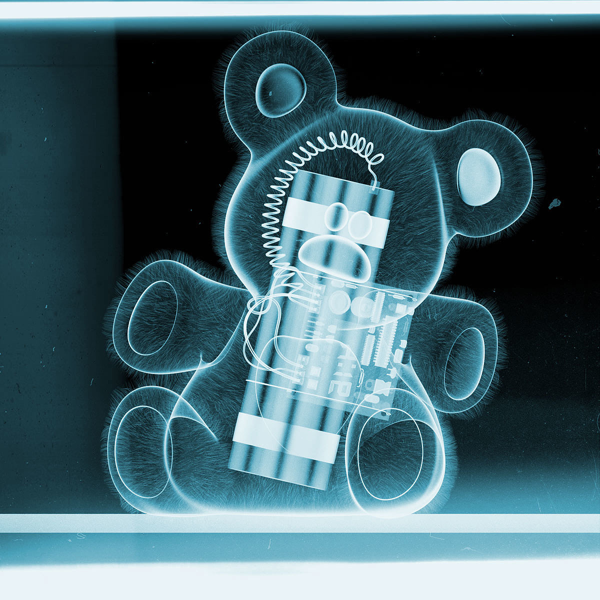 perspective，medical care，X-ray，originality，human skeleton，