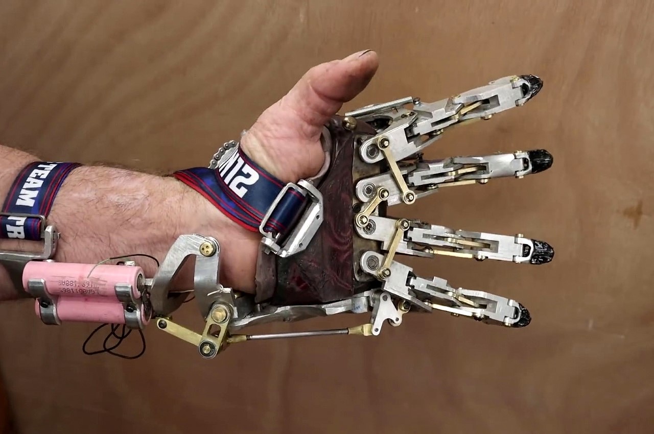 Ian Davis，Mechanical prosthesis，，a prosthesis，