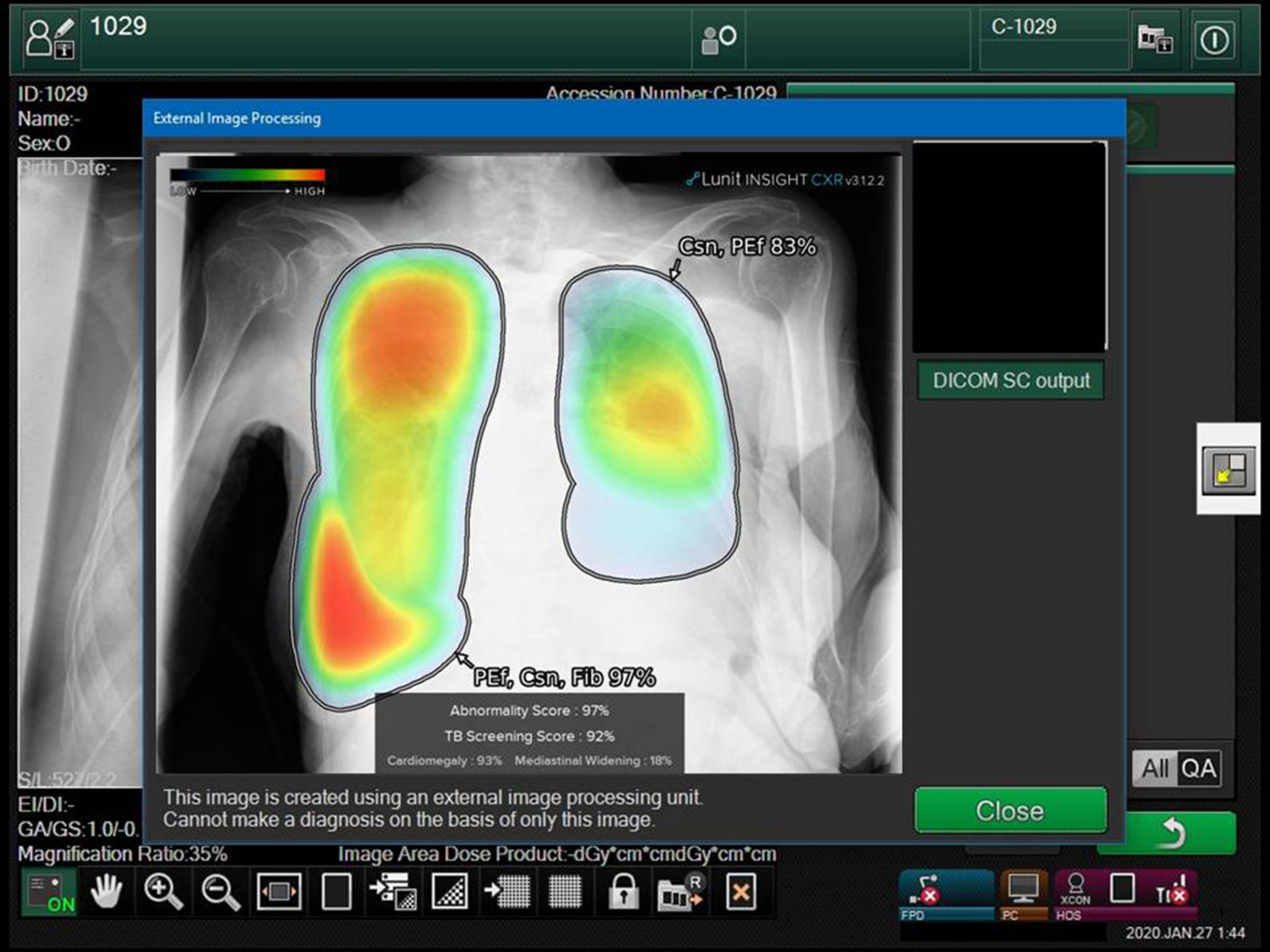 2021 red dot product design award，FDR nano，Mobile，X-ray equipment，