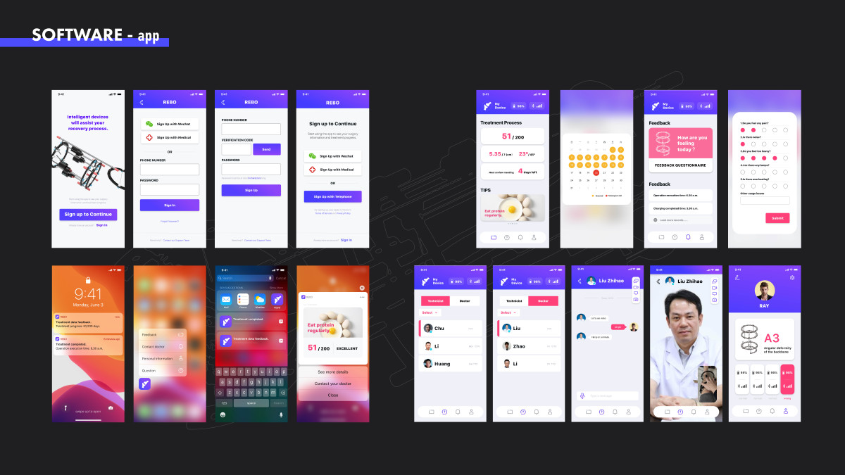 2021 undergraduate graduation design works，Graduation exhibition，School of Design, Hunan University ，Ilizanov，Bone scaffold，