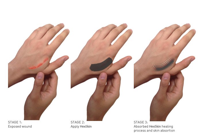 HexSkin，Healing bandage，medical care，Cool，