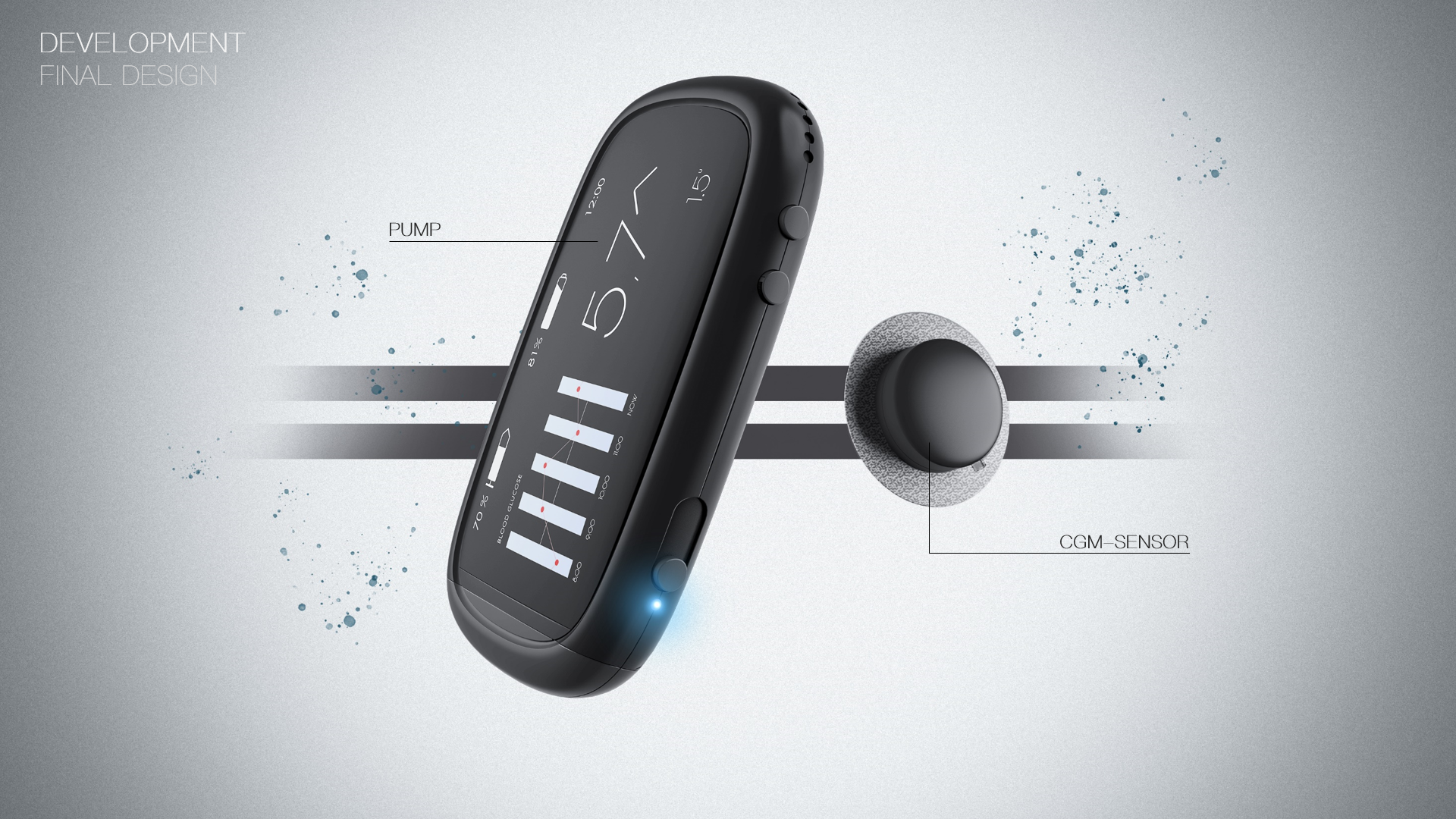 Medical products，Diabetes，insulin pump，hommization，