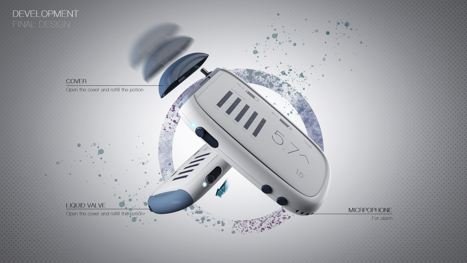 Medical products，Diabetes，insulin pump，hommization，