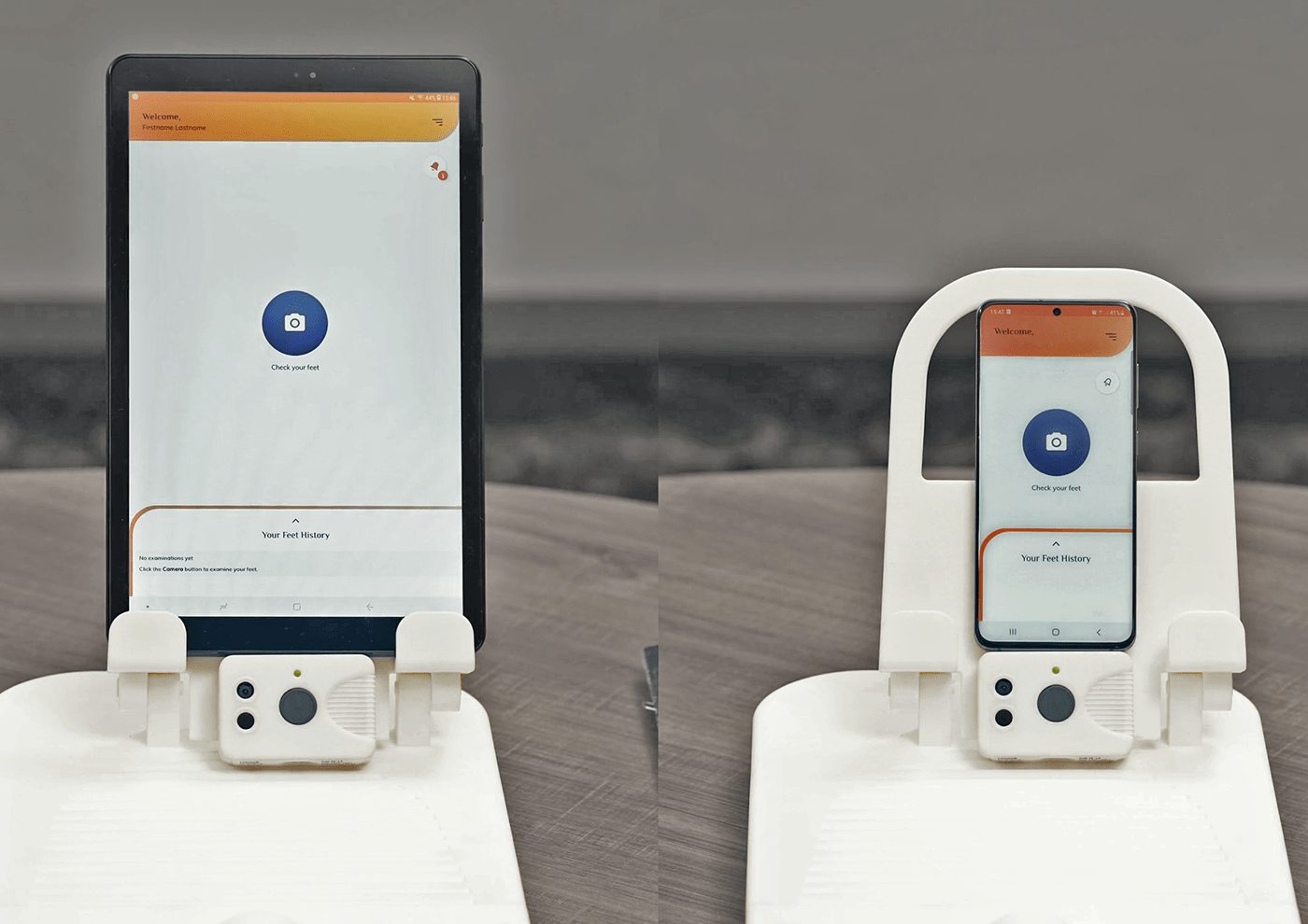 FeetSee，Diabetes，Medical equipment，