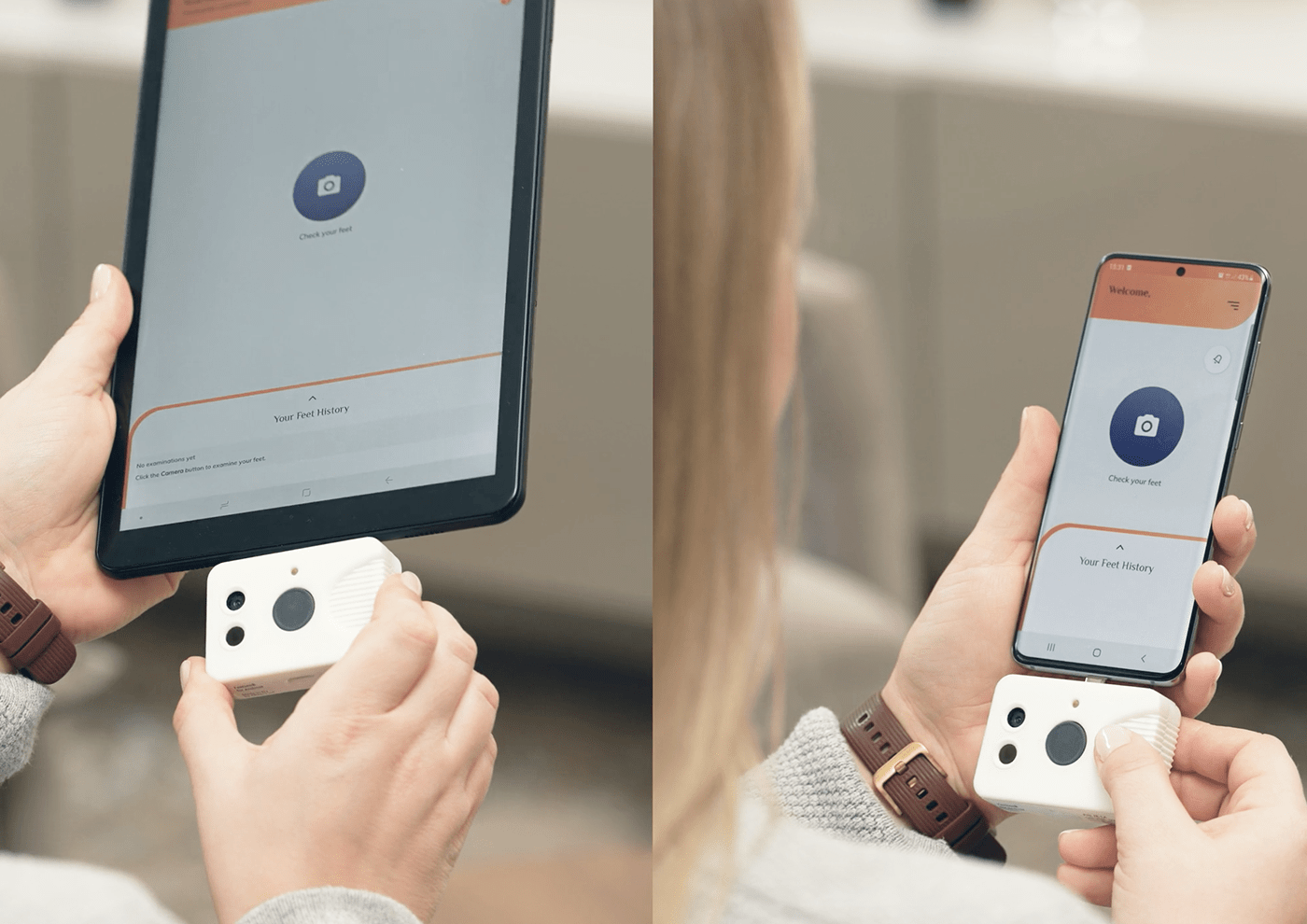 FeetSee，Diabetes，Medical equipment，