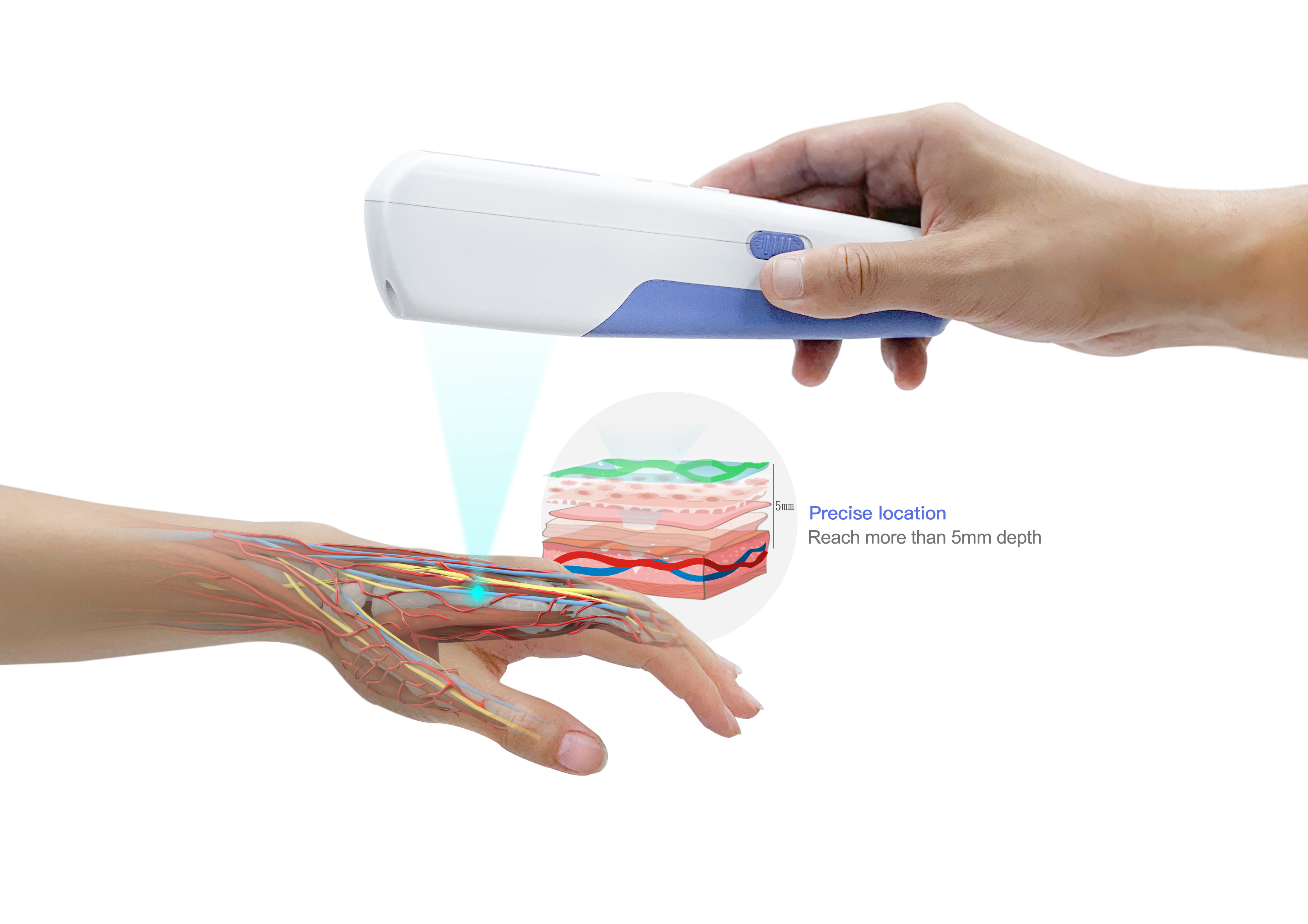 medical apparatus and instruments，Venous imaging，Instruments and equipment，