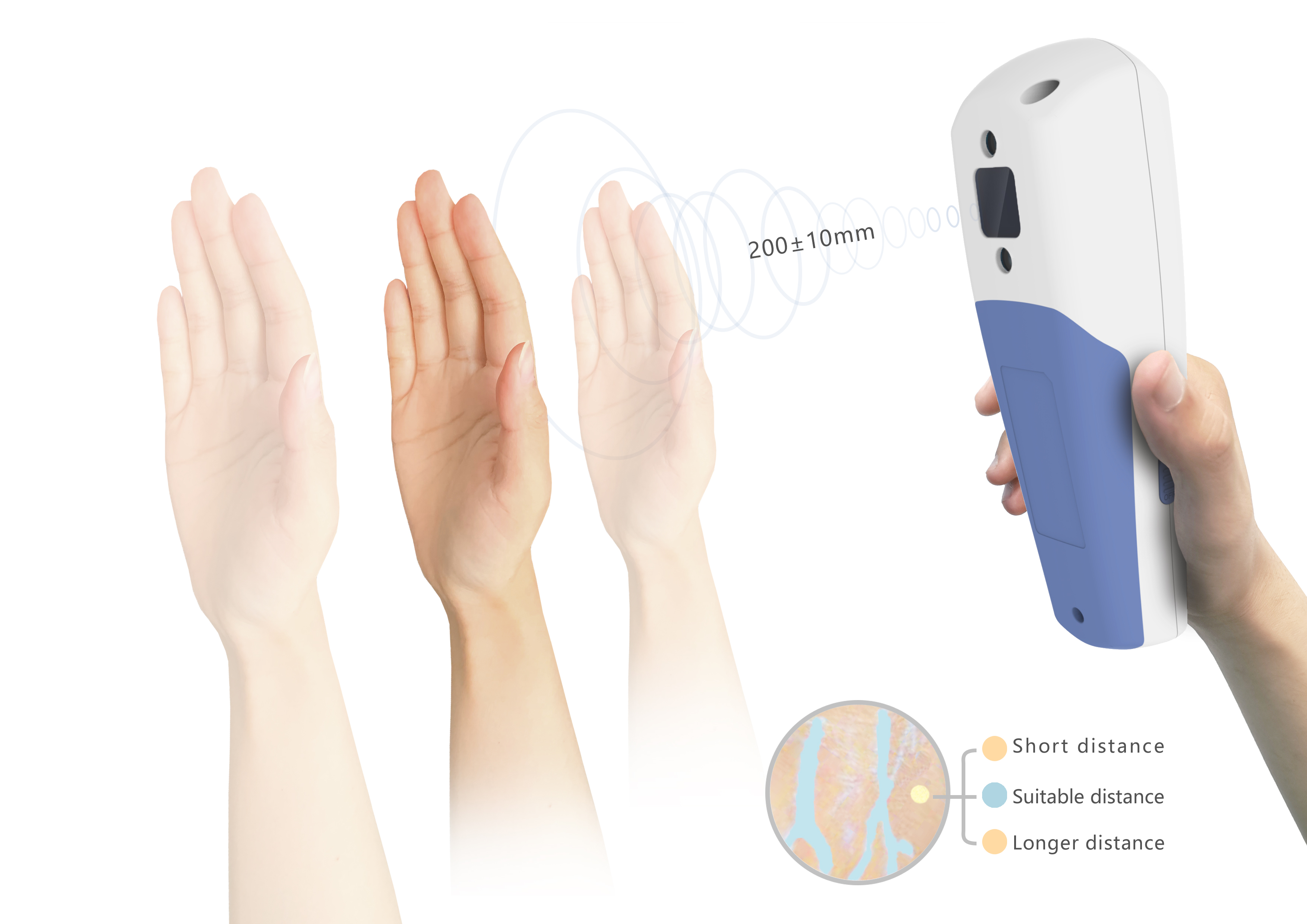 medical apparatus and instruments，Venous imaging，Instruments and equipment，