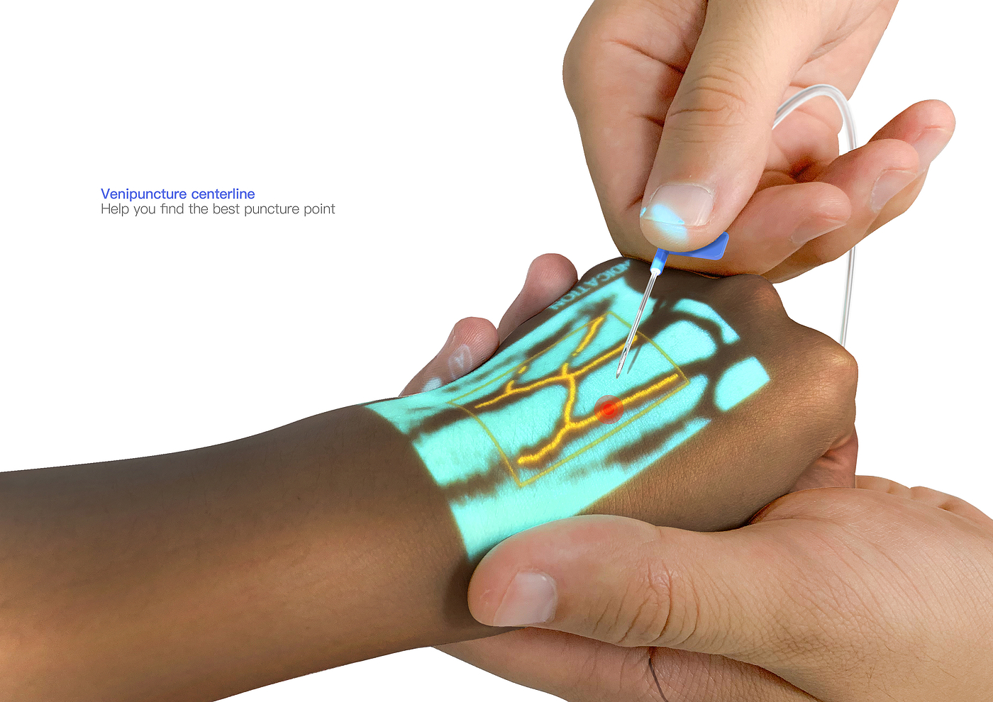medical apparatus and instruments，Venous imaging，Instruments and equipment，