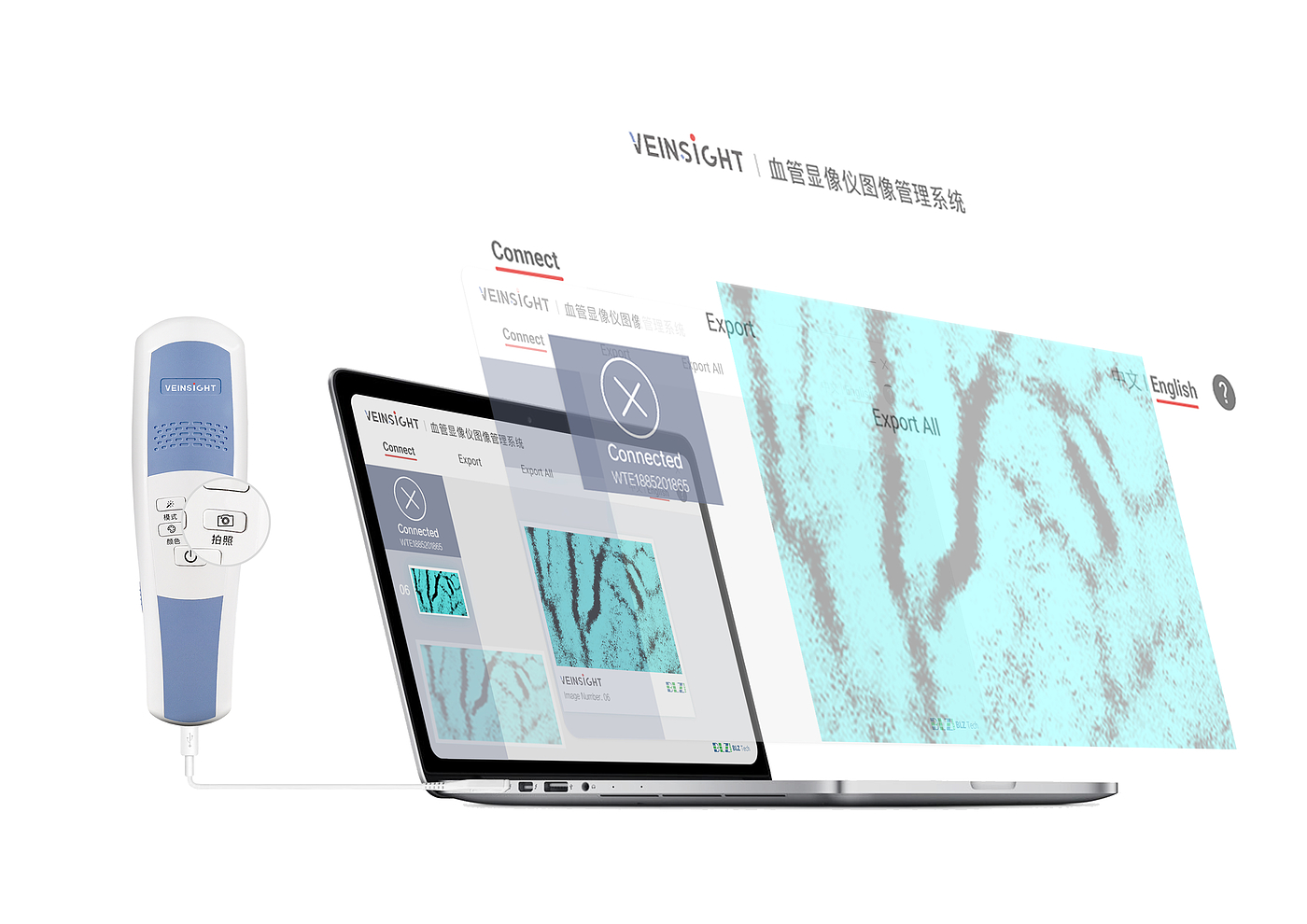 medical apparatus and instruments，Venous imaging，Instruments and equipment，