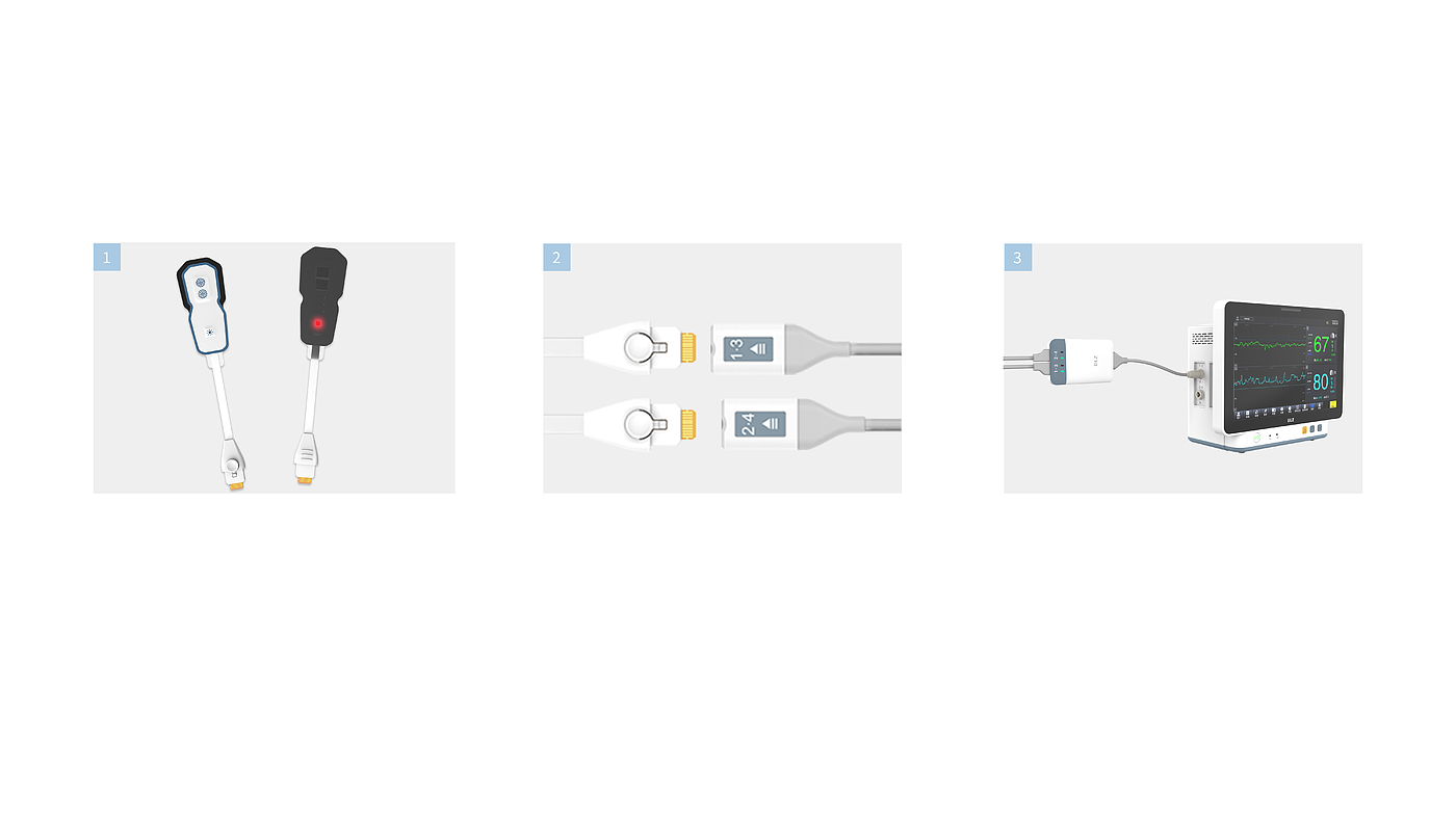 Medical Electronics，monitor，product design，