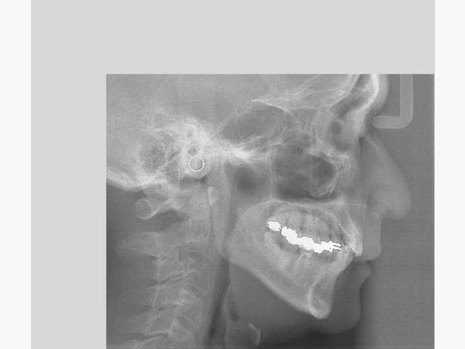 Veraview X800，Stomatology Department，Medical equipment，2017if Award，