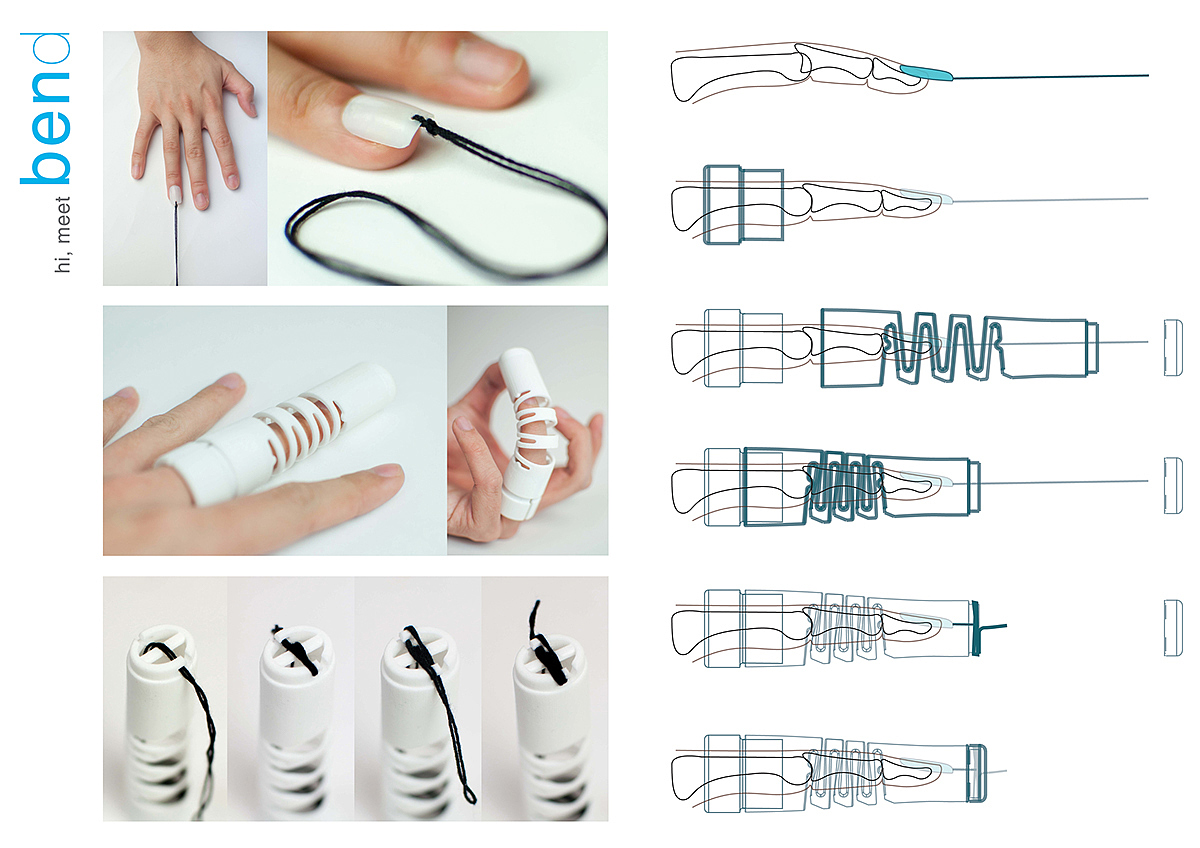 industrial design，Medical products，bend，Finger Division，