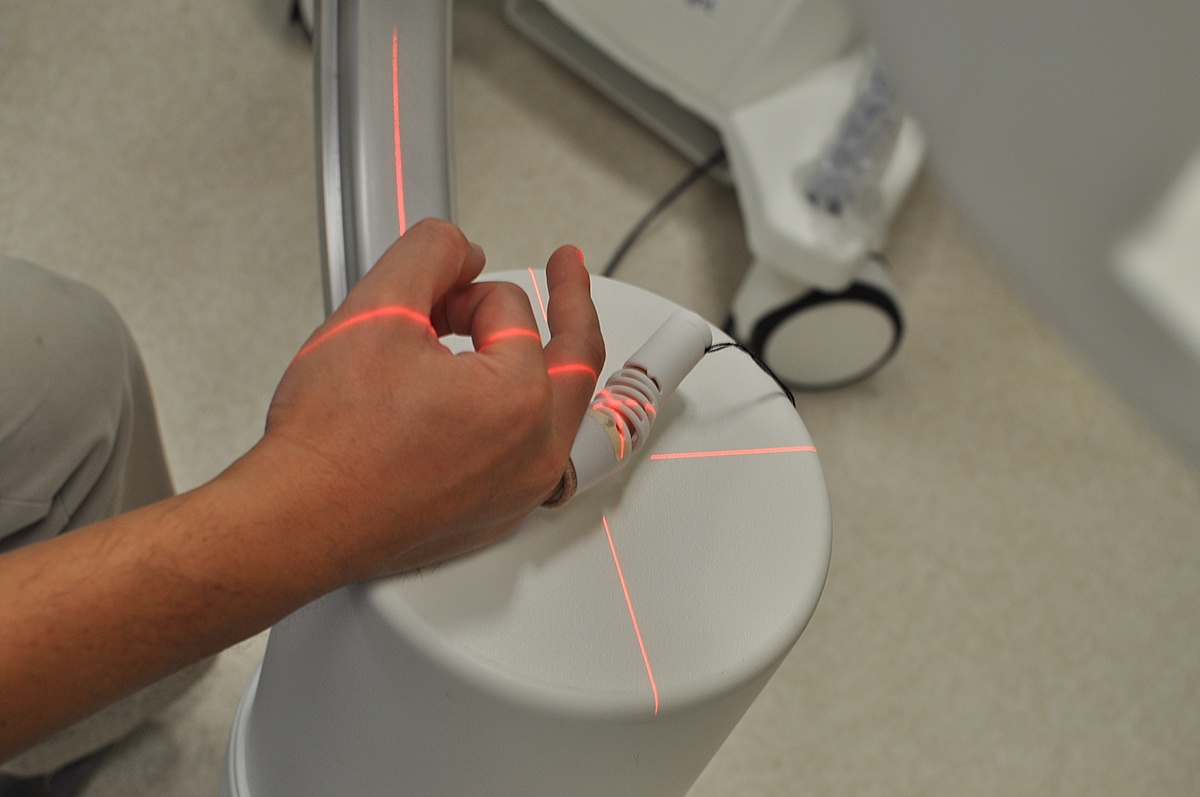 industrial design，Medical products，bend，Finger Division，