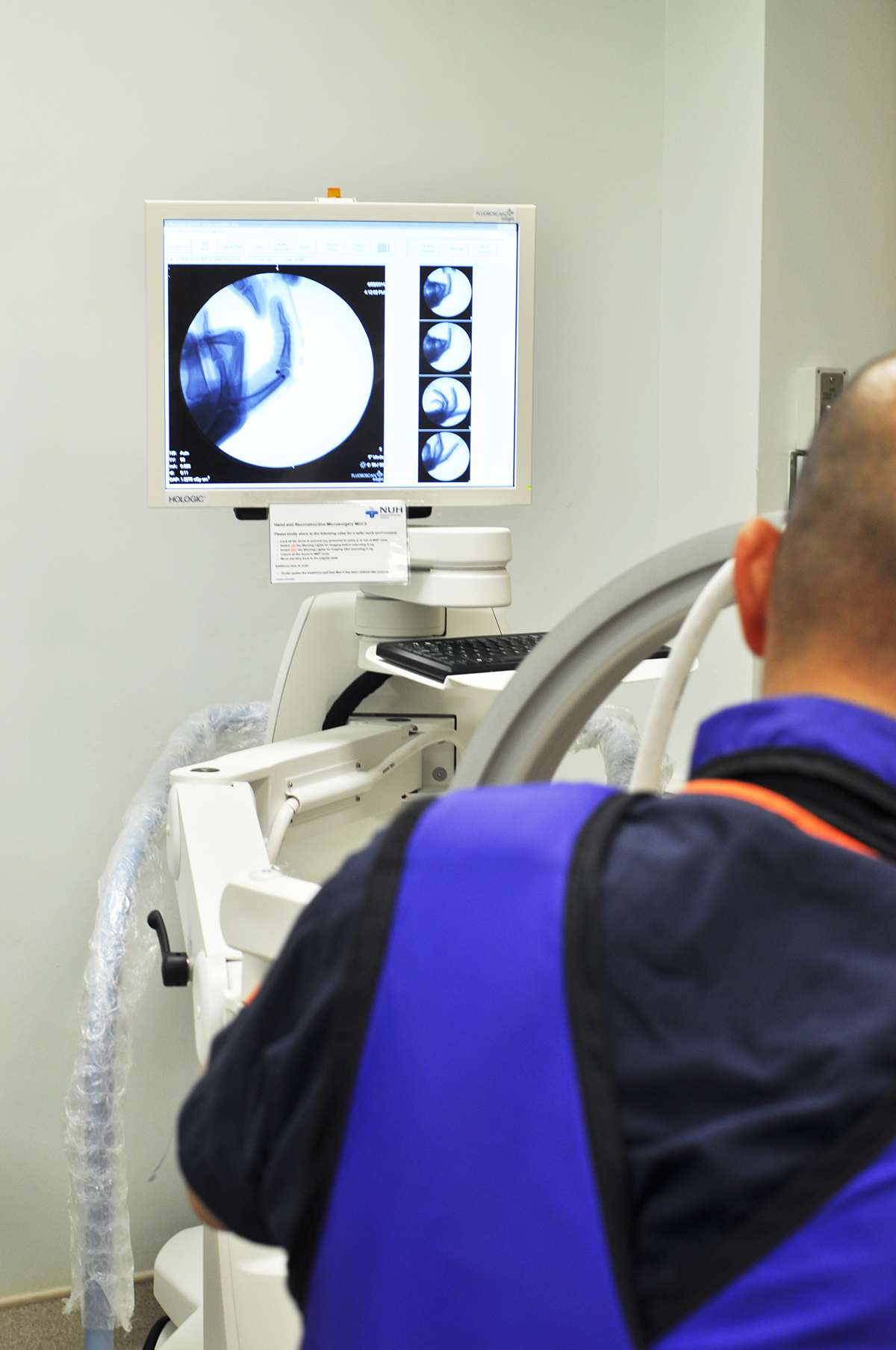 industrial design，Medical products，bend，Finger Division，