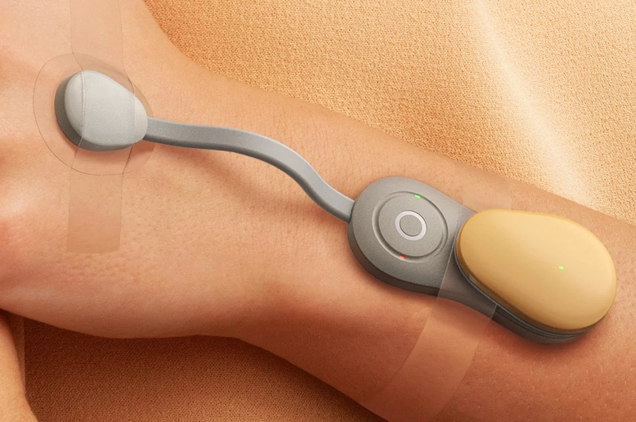 Medical equipment，beautiful，sensor，wearable devices ，diagnosis，