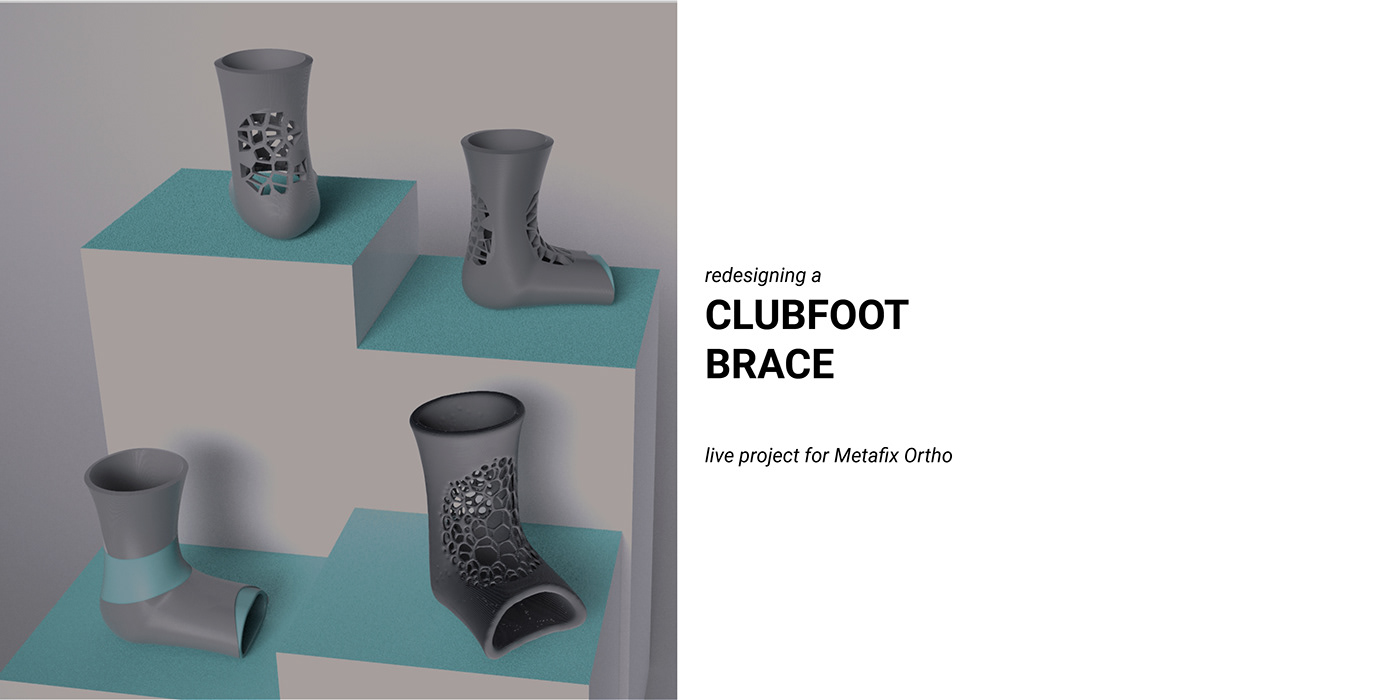Clubfoot Splint Pattern Metafix Clubfoot Brace - 普象网