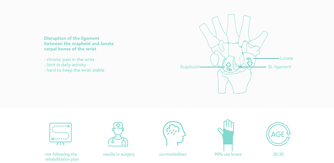 Product implementation design，Rehabilitation equipment，carpal instability ，