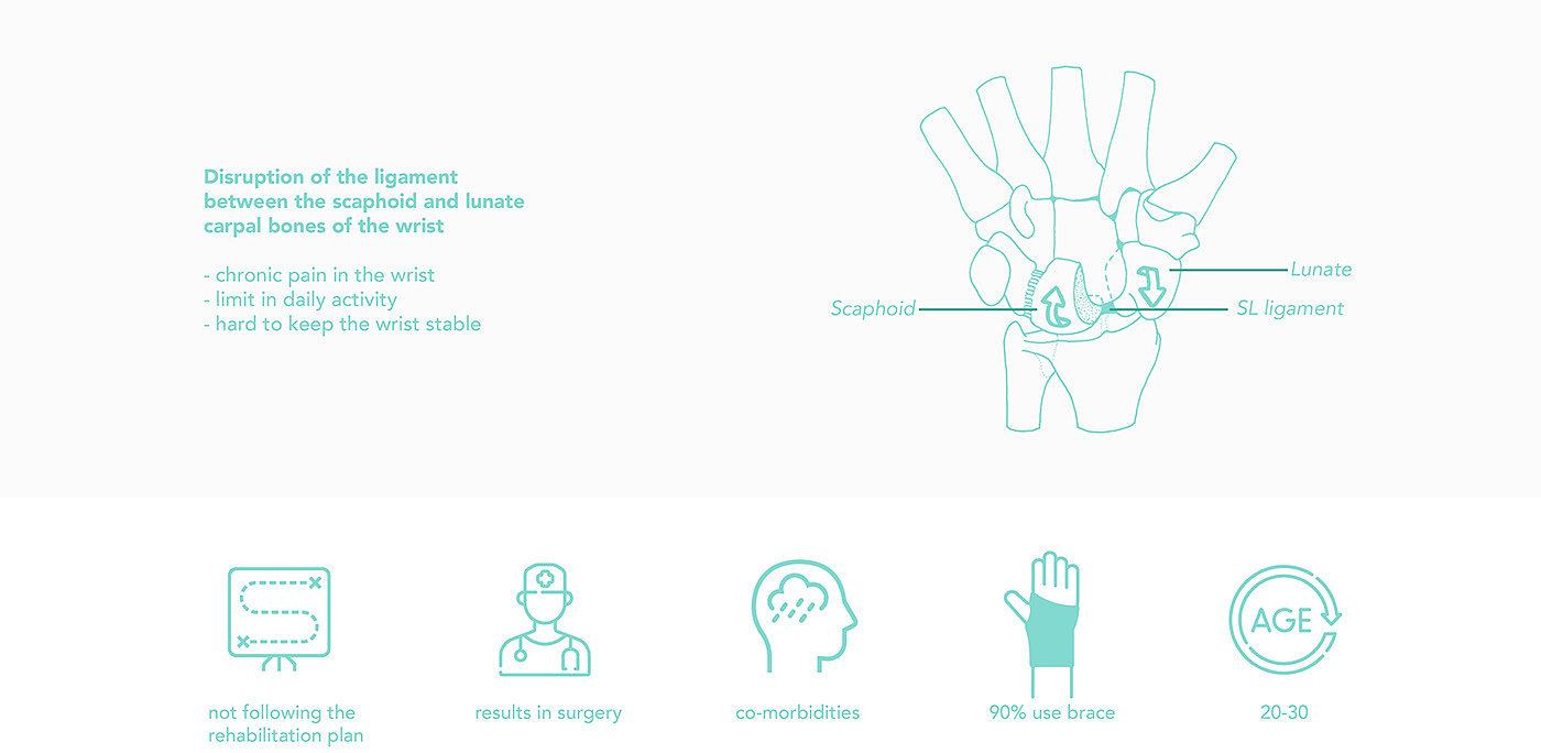 Product implementation design，Rehabilitation equipment，carpal instability ，