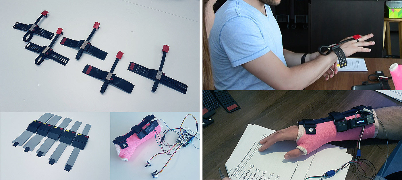 Product implementation design，Rehabilitation equipment，carpal instability ，
