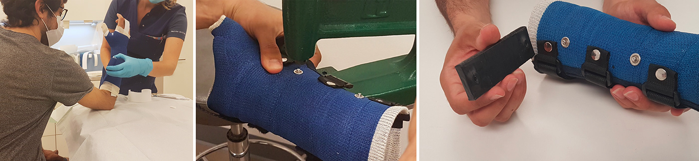 Product implementation design，Rehabilitation equipment，carpal instability ，