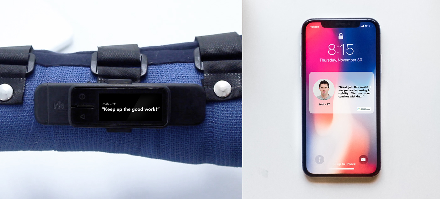 Product implementation design，Rehabilitation equipment，carpal instability ，