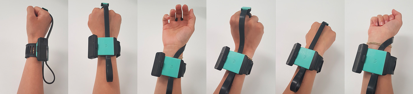 Product implementation design，Rehabilitation equipment，carpal instability ，