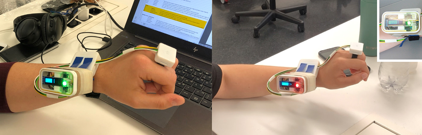 Intelligent rehabilitation equipment，MOTIVAID，SL wrist，Sustainability，Ruben van der Horst，