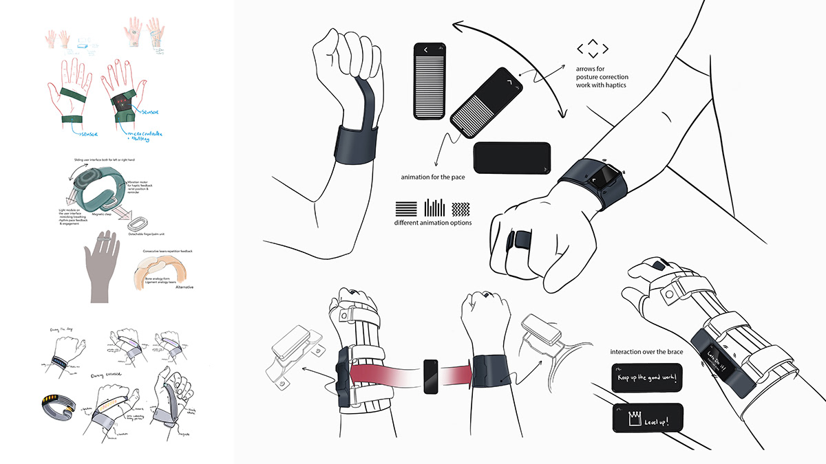 Intelligent rehabilitation equipment，MOTIVAID，SL wrist，Sustainability，Ruben van der Horst，