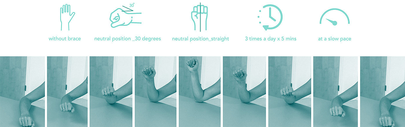 Intelligent rehabilitation equipment，MOTIVAID，SL wrist，Sustainability，Ruben van der Horst，
