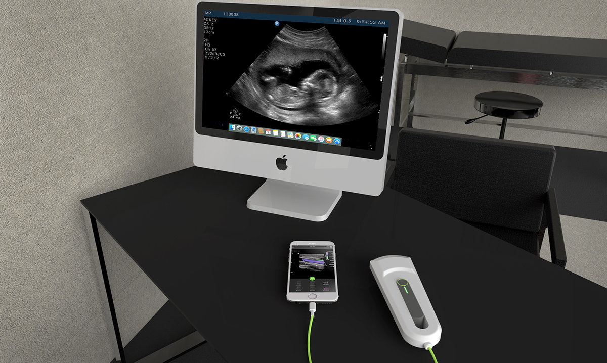 ultrasonic，Portable，medical care，