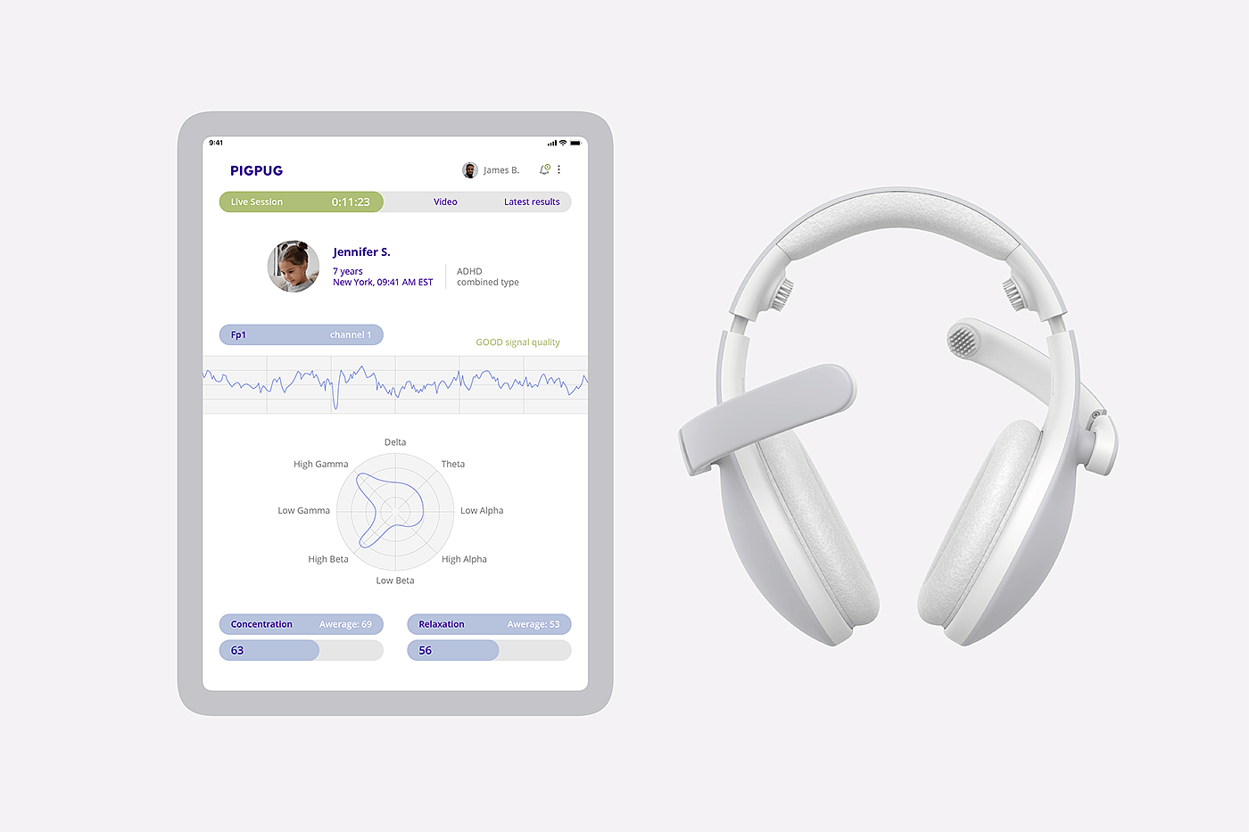 ADHD treatment，long-range，ai，headset，