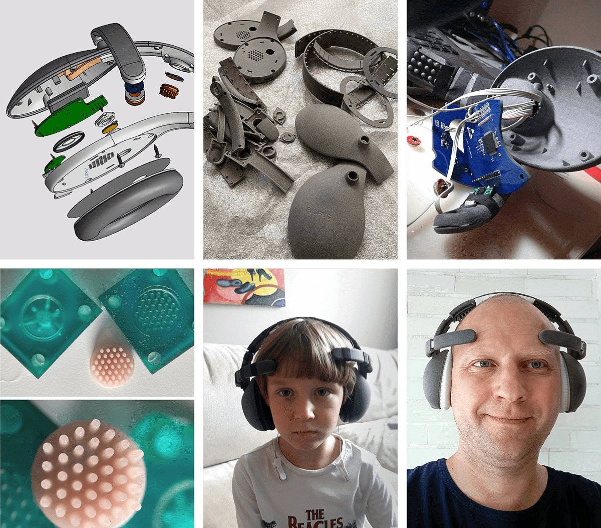 ADHD treatment，long-range，ai，headset，