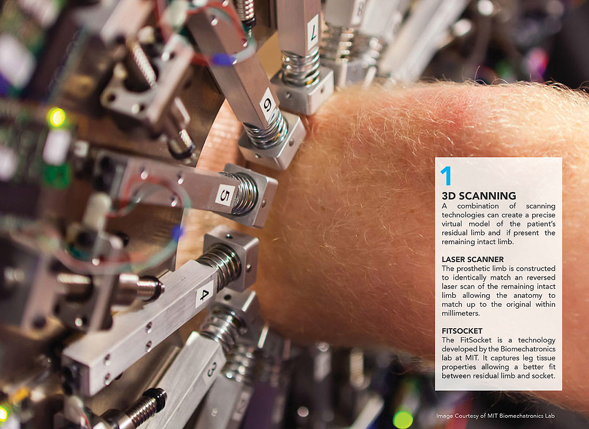 exo，Intelligent prosthesis，medical care，