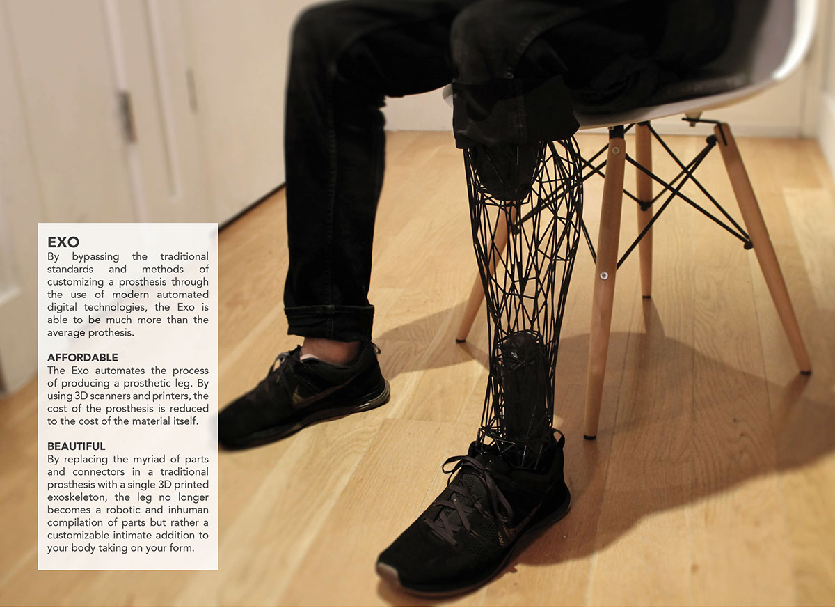 exo，Intelligent prosthesis，medical care，
