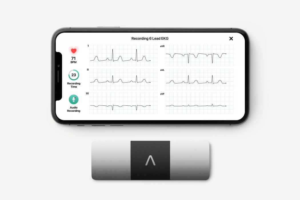 KardiaMobile 6L，Level Design SF，ECG reader，