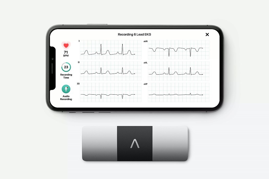 KardiaMobile 6L，Level Design SF，ECG reader，