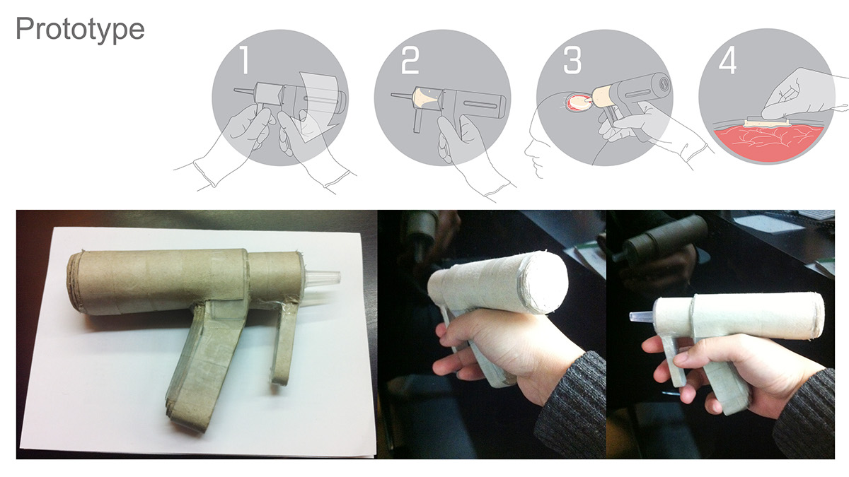 Medical equipment，Foam gun，Dural repair tool，industrial design，