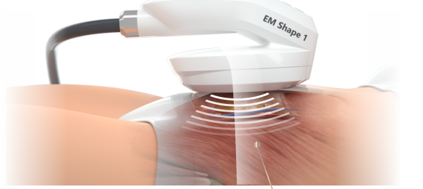 Guangzhou Zhichuang Brand Management Co., Ltd，Reducing fat and increasing muscle，Magnetic excellent plastic，No trauma，Simple operation，