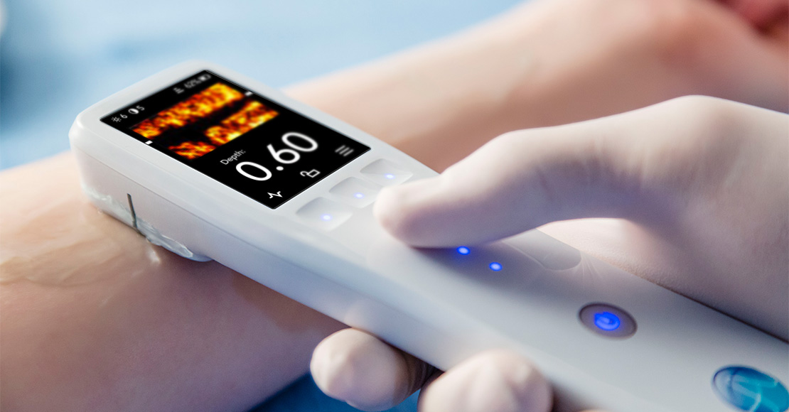 bk超声波,便携式,超声设备,医疗